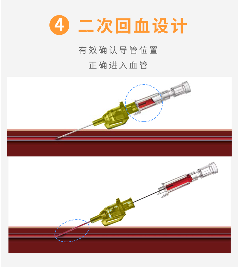 德國貝朗 Introcan-W 英初康 動靜脈留置針（帶翼） 