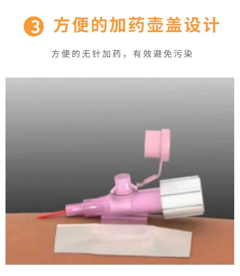 沃素安20G動(dòng)靜脈留置針