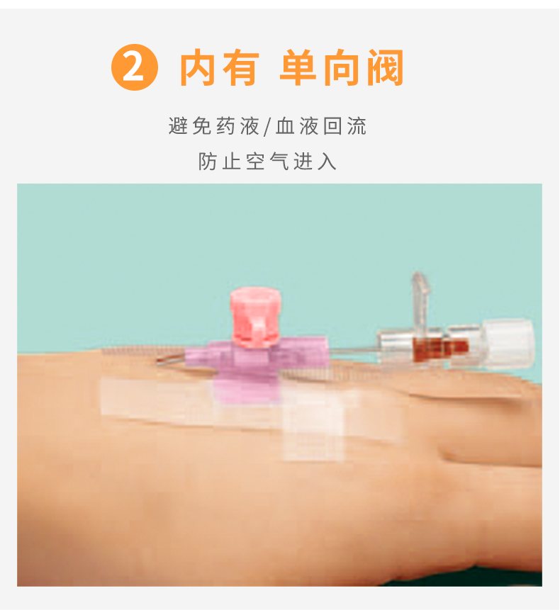 沃素安20G動(dòng)靜脈留置針